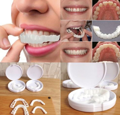 Carillas HappySmile dentales 🦷