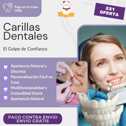 Carillas HappySmile dentales 🦷